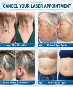 Pureluxo® 𝟕-𝐃𝒂𝘆 𝐒𝗸𝐢𝐧 𝐓𝒂𝗴 & 𝐒𝐩𝙤𝐭 𝐄𝐫𝒂𝐬𝙚𝐫 Painless & Scar-Free Advanced Imperfection Remova𝗜 Ro𝗜𝗜erba𝗜𝗜 Pen