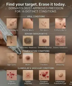 Pureluxo® 𝟕-𝐃𝒂𝘆 𝐒𝗸𝐢𝐧 𝐓𝒂𝗴 & 𝐒𝐩𝙤𝐭 𝐄𝐫𝒂𝐬𝙚𝐫 Painless & Scar-Free Advanced Imperfection Remova𝗜 Ro𝗜𝗜erba𝗜𝗜 Pen