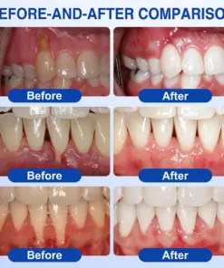 Pureluxo® GumRevive Periodontal Repair Gel