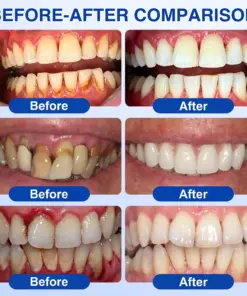 Pureluxo® GumRevive Periodontal Repair Gel